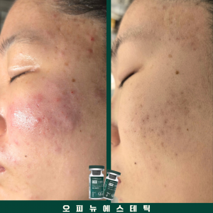 [대구 달성군] 오피뉴에스테틱